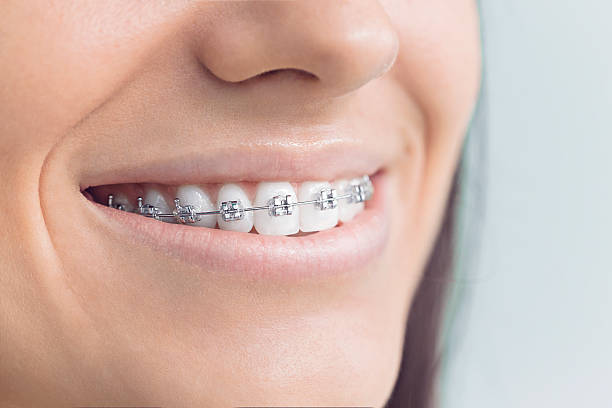 Best Dental Fillings (Composite and Amalgam)  in Combined Locks, WI